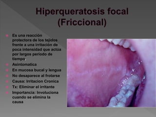  Es una reacción
protectora de los tejidos
frente a una irritación de
poca intensidad que actúa
por largos período de
tiempo.
 Asintomatica
 En mucosa bucal y lengua
 No desaparece al frotarse
 Causa: Irritacion Cronica
 Tx: Eliminar el irritante
 Importancia: Involuciona
cuando se elimina la
causa
 