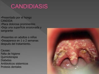 •Presentado por el hongo
CANDIDA
•Placa dolorosa prominentes
•Deja una superficie erosionada y
sangrante
•Presentes en adultos o niños
•Desaparece en 1 o 2 semanas
después del tratamiento.
Causas:
Falta de higiene
Quimioterapia
Diabetes
Antibioticos sistemicos
Protesis dentales
 