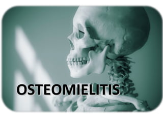 OSTEOMIELITISOSTEOMIELITIS
 
