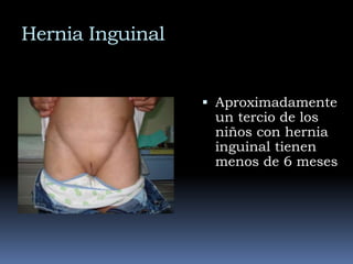 La porción del proceso vaginal que envuelve el testículo es la túnica vaginalisEmbriologíaEl resto del proceso vaginal se oblitera en el canal inguinal