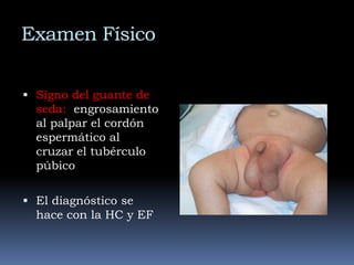 La incidencia es mayor en prematuros (15– 25%)Hernia InguinalAproximadamente un tercio de los niños con hernia inguinal tienen menos de 6 meses