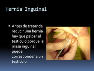 Manifestaciones clínicasMasa en la región inguinal que se extiende hacia el escrotoAparece con el aumento de la presión intra abdominalPuede estar presente al nacimiento o aparecer luego