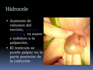 Riesgo de encarcelación: