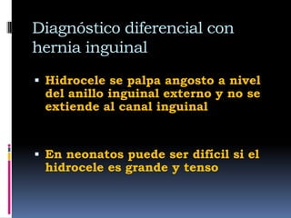 Hidrocele
