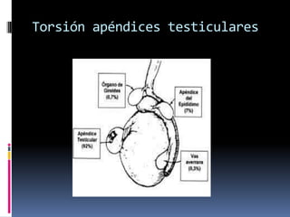 Si el varicocele es derecho hay que indagar patología asociada (masa abdominal)