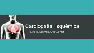 Cardiopatía isquémica
CARLOS ALBERTO BAUTISTA ORTIZ
 