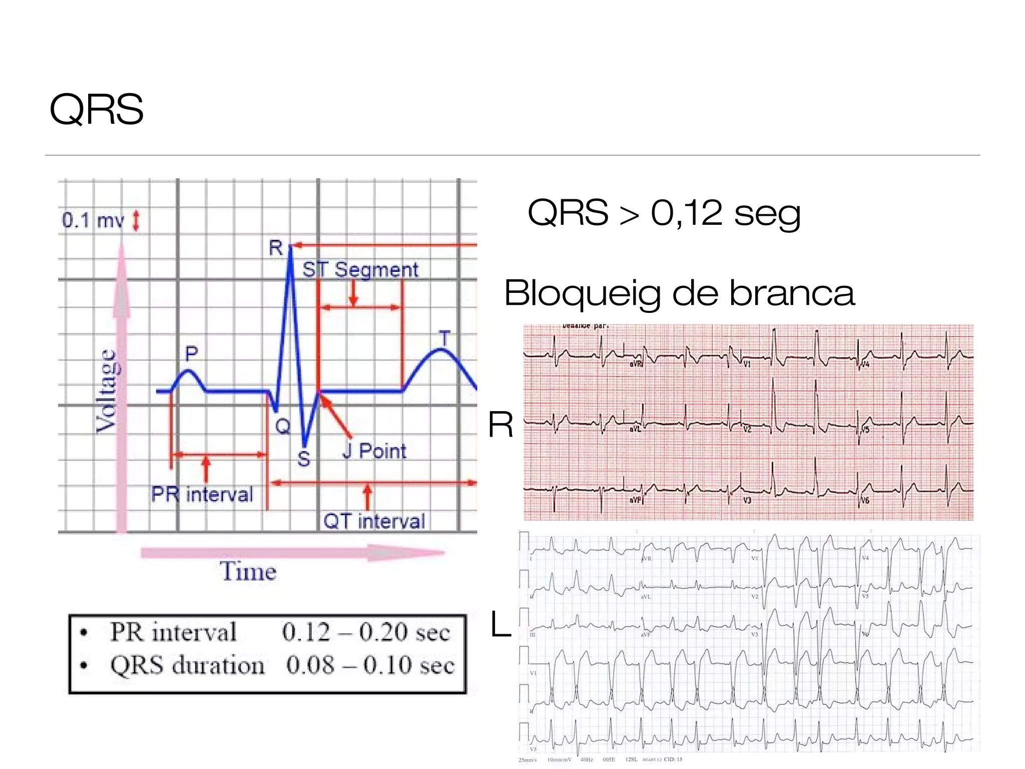 patologia-cardiovascular-ppt