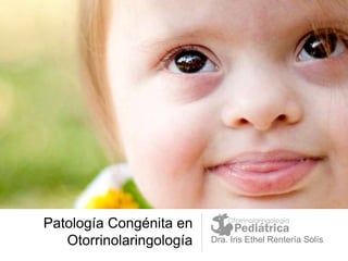 Patología Congénita en
Otorrinolaringología Dra. Iris Ethel Rentería Solís
 