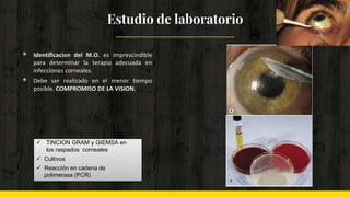 Estudio de laboratorio
◈ Identificacion del M.O. es imprescindible
para determinar la terapia adecuada en
infecciones corneales.
◈ Debe ser realizado en el menor tiempo
posible. COMPROMISO DE LA VISION.
 TINCION GRAM y GIEMSA en
los raspados corneales
 Cultivos
 Reacción en cadena de
polimerasa (PCR)
 