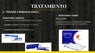 ◈ Antivirales orales
ACICLOVIR
Importancia critica en el tratamiento, sobretodo
en individuos atopicos que son susceptibles.
TRATAMIENTO
2.- TERAPIA FARMACOLOGICA:
Antivirales topicos:
Idoxuridina, trifluridina, vidarabina, ganciclovir y aciclovir
Ganciclovir y aciclovir = en enfermedad de estroma
Idoxuridina y trifluridina= Epitelopatia toxica
 