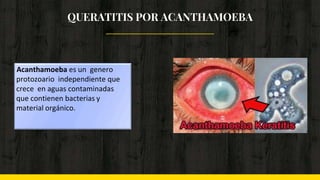 QUERATITIS POR ACANTHAMOEBA
Acanthamoeba es un genero
protozoario independiente que
crece en aguas contaminadas
que contienen bacterias y
material orgánico.
 