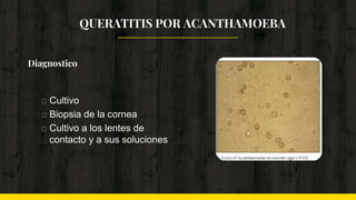 Diagnostico
Cultivo
Biopsia de la cornea
Cultivo a los lentes de
contacto y a sus soluciones
QUERATITIS POR ACANTHAMOEBA
 