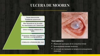 ULCERA DE MOOREN
TRATAMIENTO
• Resección quirúrgica de la conjuntiva limbal
• Queratoplastia lamelar tectónica
• A menudo es necesaria la terapia inmunosupresora
sistémica
Causa desconocida.
Posiblemte autoimnune
Mas frecuente en la 3ra edad
No relacionada a enf. Sistemicas
Ulcera marginal unilateral 60 a
80%
Excavacion dolorosa y progresiva
del limbo y cornea periferica
CONDUCE A PERDIDA DEL OJO
 