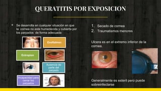 QUERATITIS POR EXPOSICION
◈ Se desarrolla en cualquier situación en que
la cornea no este humedecida y cubierta por
los parpados de forma adecuada:
1. Secado de cornea
2. Traumatismos menores
Ulcera es en el extremo inferior de la
cornea.
Generalmente es esteril pero puede
sobreinfectarse
Exoftalmos
Ectropion
Ausencia de
parte del
parpado
Incapacidad para
cerrar los
parpados
 