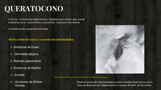 QUERATOCONO
1) Es una enfermedad degenerativa bilateral poco común que puede
heredarse como característica autosómica recesiva o dominante
2) Unilateral de causas desconocidas
Afecta a todas las razas y se asocia con enfermedades:
 Síndrome de Down
 Dermatitis atópica
 Retinitis pigmentaria
 Síndrome de Marfan
 Aniridia
 Síndrome de Ehlers-
Danlos.
Desde el punto de vista patológico existen cambios destructivos de la
Capa de Bowman con degeneración y ruptura de la M. de Descemet
 