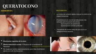 QUERATOCONO
HIDROPESIA
• Disminucion repentina de la vision
• Edema central de la cornea → Ruptura de la membrana de
Descemet
• Por lo general remite espontaneamente, pero deja cicatrizacion
apical y en la M. de Descemet.
• Los lentes de contacto rígidos mejoran la visión en las
etapas tempranas.
• El queratocono es una de las indicaciones más
comunes para trasplante de córnea:
Queratoplastia de penetrcion
Queratoplastia lamelar profunda.
• Transplante de cornea antes de que ocurra un
adelgazamiento extremo.
TRATAMIENTO
 