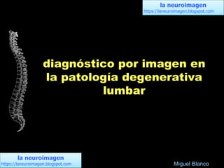 la neuroimagen
https://laneuroimagen.blogspot.com
la neuroimagen
https://laneuroimagen.blogspot.com
diagnóstico por imagen en
la patología degenerativa
lumbar
Miguel Blanco
 