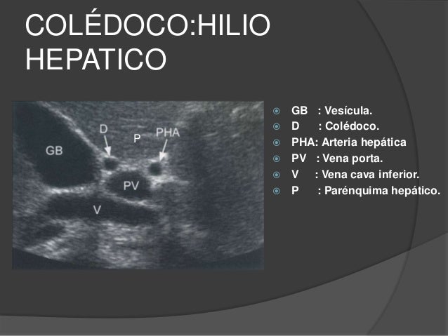 Patologia de higado y vesicula ii