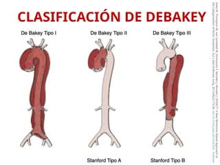 Comprehensive Overview of Aortic Pathology and Aneurysms: Diagnosis and ...