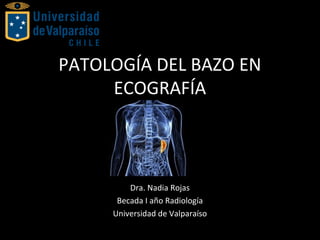 PATOLOGÍA DEL BAZO EN
ECOGRAFÍA
Dra. Nadia Rojas
Becada I año Radiología
Universidad de Valparaíso
 