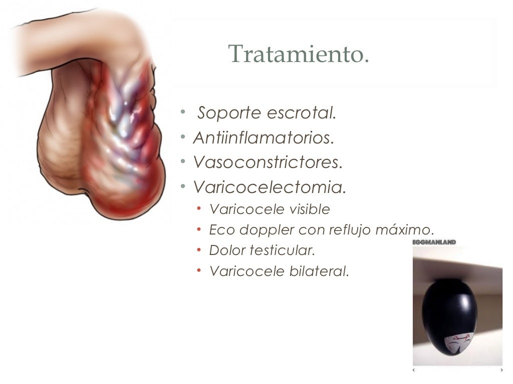Patologia del escroto Patologia del escroto
