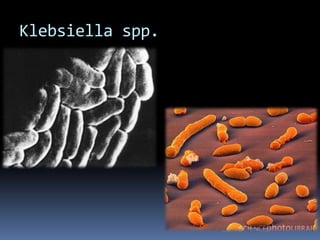 Klebsiella spp.
 