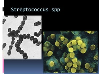 Streptococcus spp
 