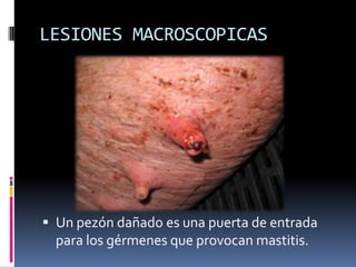 LESIONES MACROSCOPICAS




 Un pezón dañado es una puerta de entrada
  para los gérmenes que provocan mastitis.
 