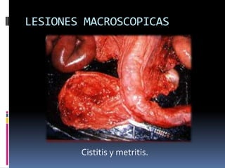 LESIONES MACROSCOPICAS




        Cistitis y metritis.
 