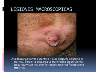 LESIONES MACROSCOPICAS




Una descarga vulvar durante 2-3 días después del parto es
  normal, pero si la descarga se transforma en purulenta,
  pegajosa y con mal olor, entonces estamos frente a una
  metritis.
 