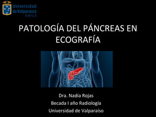 PATOLOGÍA DEL PÁNCREAS EN
ECOGRAFÍA
Dra. Nadia Rojas
Becada I año Radiología
Universidad de Valparaíso
 