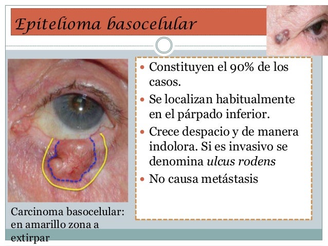 La máscara para la persona de la miel y el aceite de oliva y la leche