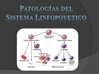 Patologías del Sistema Linfopoyetico 
