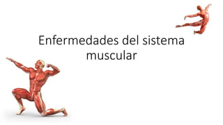 Enfermedades del sistema
muscular
 