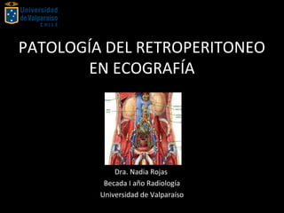 PATOLOGÍA DEL RETROPERITONEO
EN ECOGRAFÍA
Dra. Nadia Rojas
Becada I año Radiología
Universidad de Valparaíso
 
