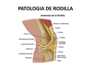 PATOLOGIA DE RODILLA
 