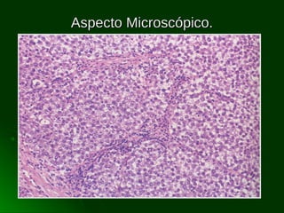 Aspecto Microscópico.

 