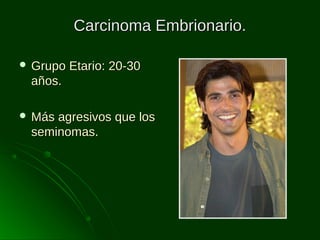 Carcinoma Embrionario.
 Grupo

Etario: 20-30

años.
 Más

agresivos que los
seminomas.

 