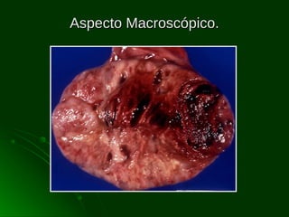 Aspecto Macroscópico.

 