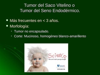 Tumor del Saco Vitelino o
Tumor del Seno Endodérmico.
 Más

frecuentes en < 3 años.
 Morfología:
•
•

Tumor no encapsulado.
Corte: Mucinoso, homogéneo blanco-amarillento

 