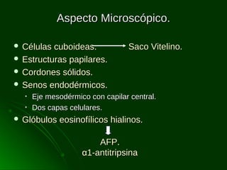 Aspecto Microscópico.
 Células

cuboideas.
 Estructuras papilares.
 Cordones sólidos.
 Senos endodérmicos.
•
•

Saco Vitelino.

Eje mesodérmico con capilar central.
Dos capas celulares.

 Glóbulos

eosinofílicos hialinos.
AFP.
α1-antitripsina

 