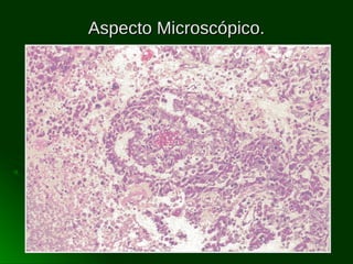 Aspecto Microscópico.

 