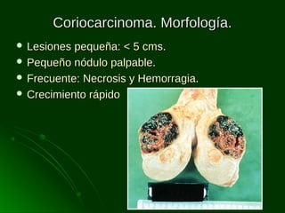 Coriocarcinoma. Morfología.
 Lesiones

pequeña: < 5 cms.
 Pequeño nódulo palpable.
 Frecuente: Necrosis y Hemorragia.
 Crecimiento rápido

 