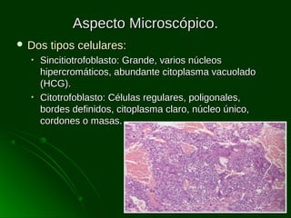 Aspecto Microscópico.
 Dos
•

•

tipos celulares:

Sincitiotrofoblasto: Grande, varios núcleos
hipercromáticos, abundante citoplasma vacuolado
(HCG).
Citotrofoblasto: Células regulares, poligonales,
bordes definidos, citoplasma claro, núcleo único,
cordones o masas.

 