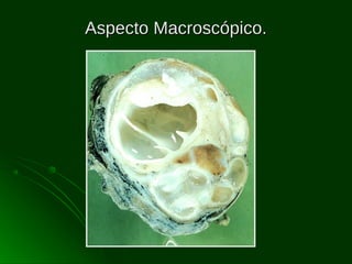 Aspecto Macroscópico.

 