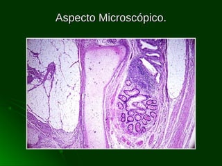 Aspecto Microscópico.

 