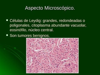 Aspecto Microscópico.
 Células

de Leydig: grandes, redondeadas o
poligonales, citoplasma abundante vacuolar,
eosinófilo, núcleo central.
 Son tumores benignos.

 