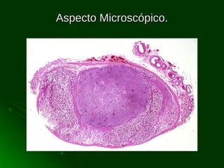 Aspecto Microscópico.

 