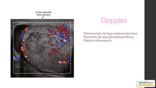 Pyomyoma Comprehensive Ultrasonographic Approach to Uterine Pathology ...