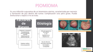 Pyomyoma Comprehensive Ultrasonographic Approach to Uterine Pathology ...